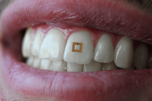 Tooth Mounted Sensors - WinfiY crunch